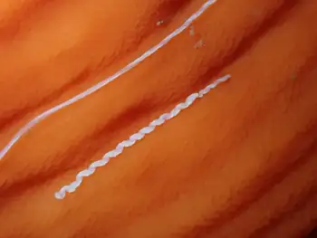 Metridium Anemone