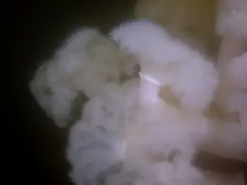 metridium anemone