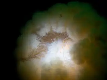 Metridium Anemone